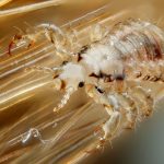head lice アタマジラミ