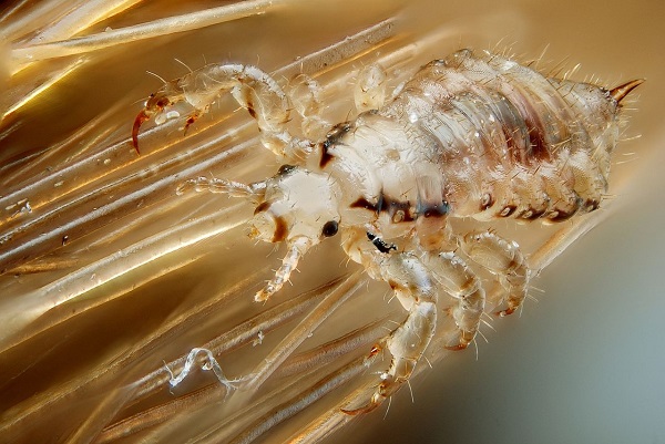 head lice アタマジラミ